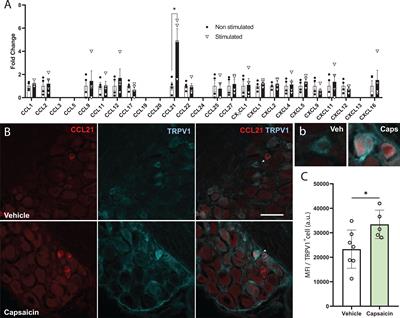 Nociception-Dependent CCL21 Induces Dorsal Root Ganglia Axonal Growth via CCR7-ERK Activation
